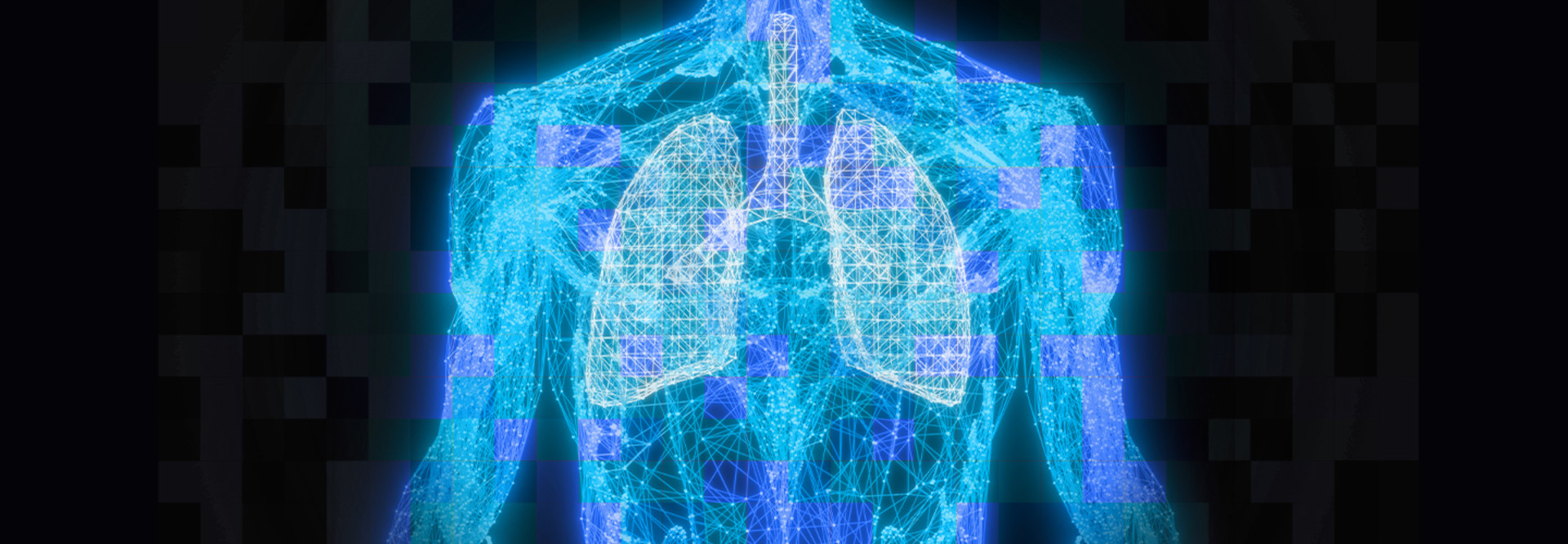 Lung can 
