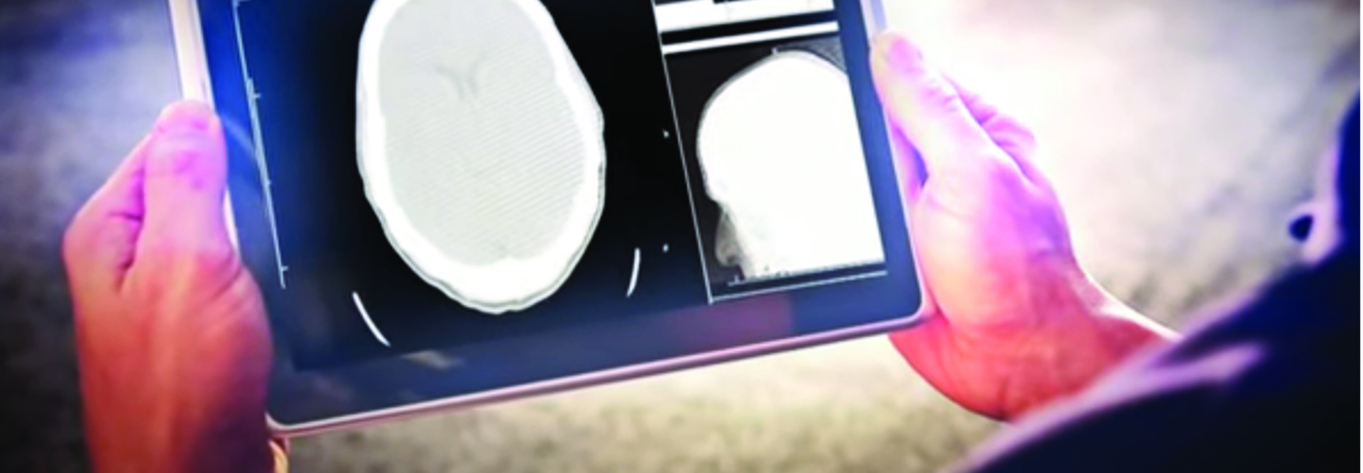 Hands holding a tablet with an image of a brain scan