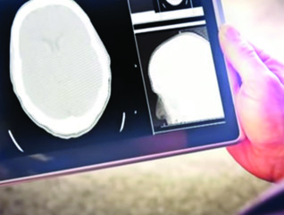 Hands holding a tablet with an image of a brain scan