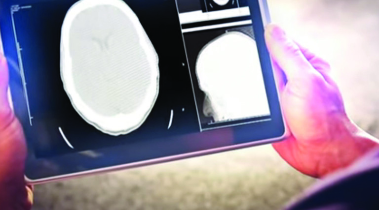 Hands holding a tablet with an image of a brain scan