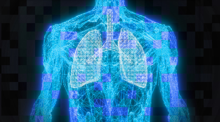 Lung can 